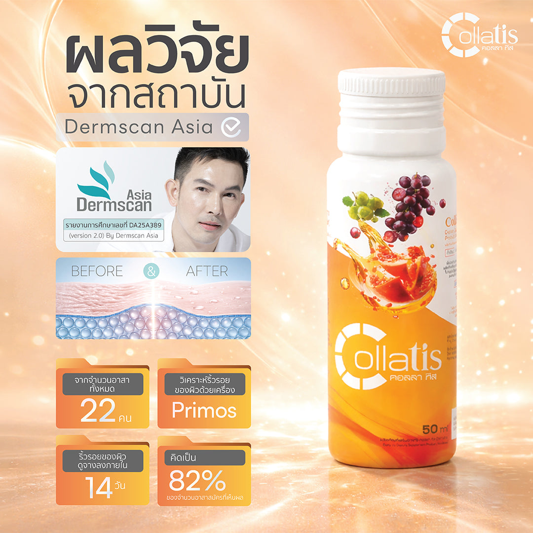 Collatis l คอลลา ทิส